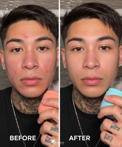 All4You™ Ice Roller